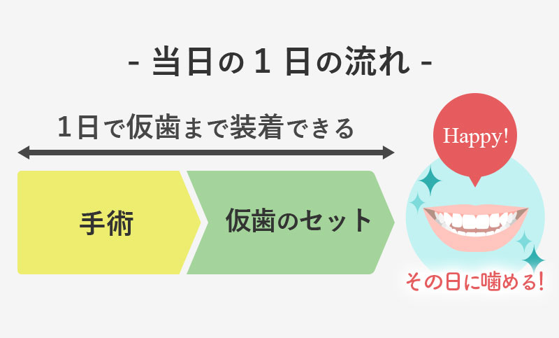 当日1日の流れ