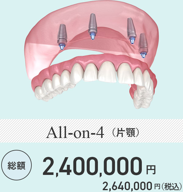 最終的な人工歯の装着